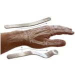 The two splints Two mouldable aluminium splints placed over an X-ray style hand