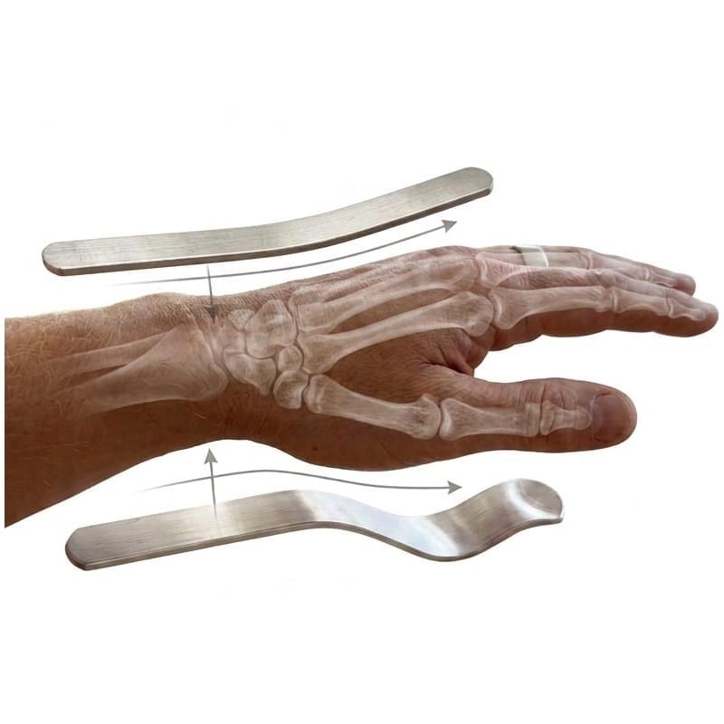 Two mouldable aluminium splints placed over an X-ray style hand